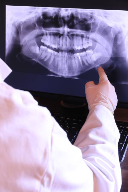 Best Emergency Treatment for Dental Infections or Abscesses in Elmwood Park, NJ