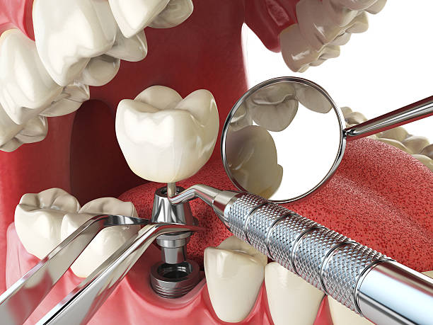 Best Emergency Dental Care for Broken or Chipped Teeth in Elmwood Park, NJ